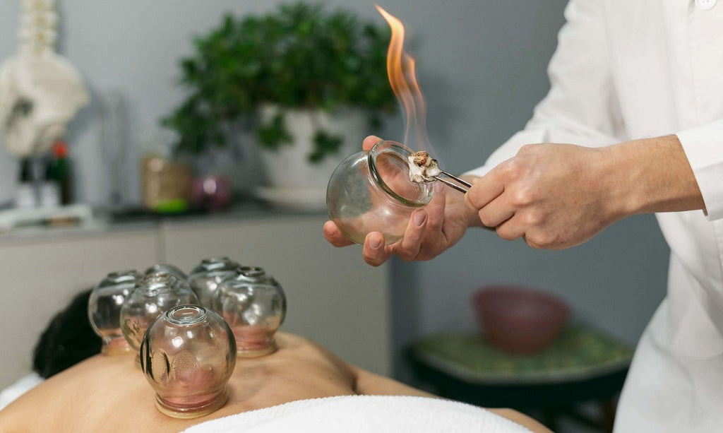 Terapia con Ventosas, Conoce Más Sobre Esta Práctica